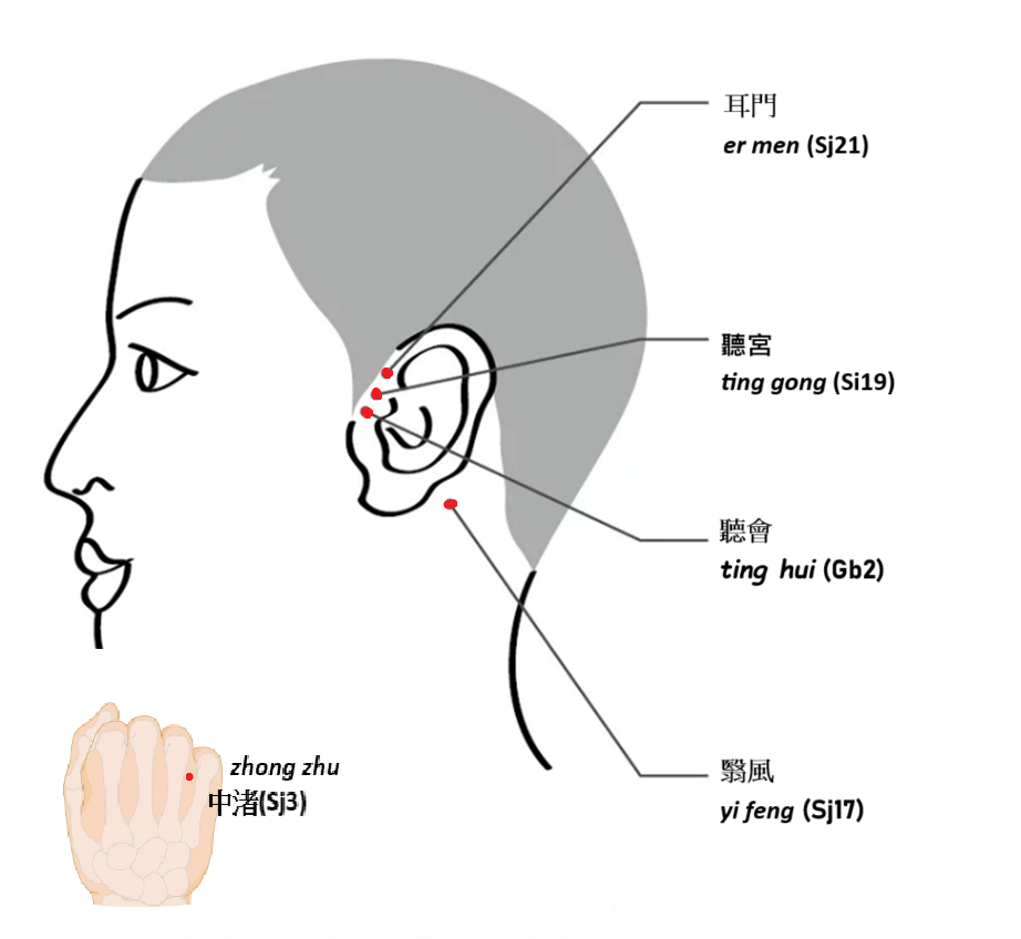 Acupuncture points for ear ringing